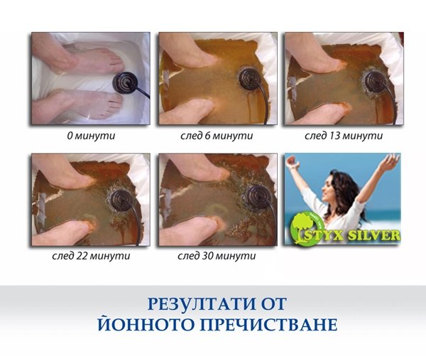 Детоксикация