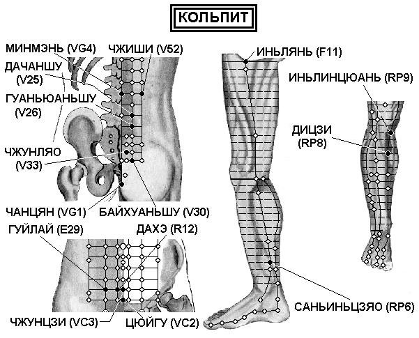 ВАГИНИТ | ЕЛЕКТРОПУНКТУРА