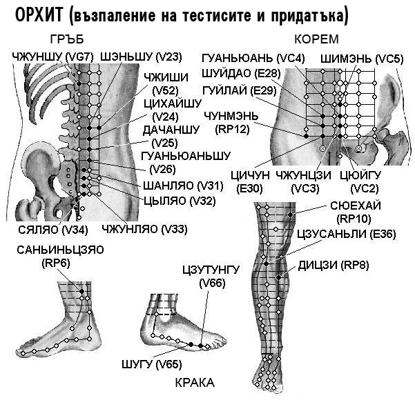 ОРХИТ | ЕЛЕКТРОПУНКТУРА