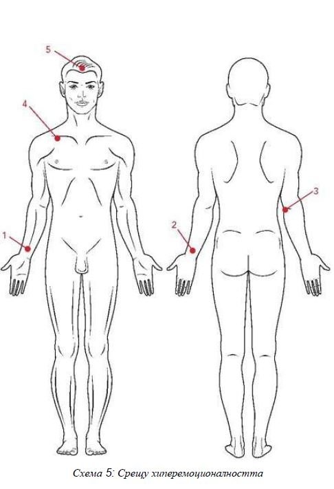 ВЕРИГА №5 ХИПЕРЕМОЦИОНАЛНОСТ | ЕЛЕКТРОПУНКТУРА