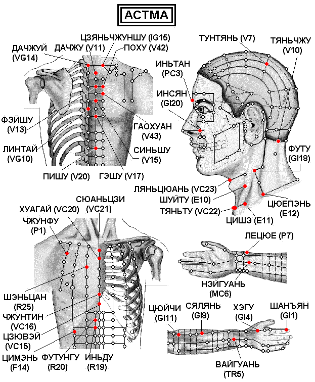 Иглоукалывание точки на теле схема и что лечит