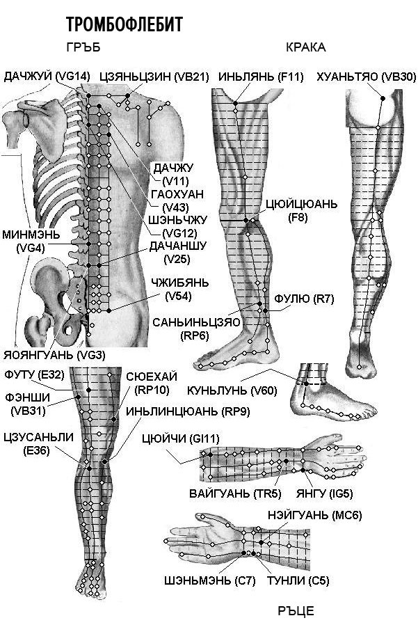 Массаж при тромбофлебите. Рефлексотерапия варикоз схема точек. Эледиа акупунктура атлас. Точки акупунктуры при заболеваниях. Точки акупунктуры при заболеваниях конечностей.
