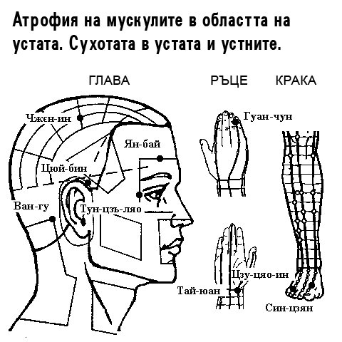 АТРОФИЯ НА МУСКУЛИТЕ, СУХОТА | ЕЛЕКТРОПУНКТУРА