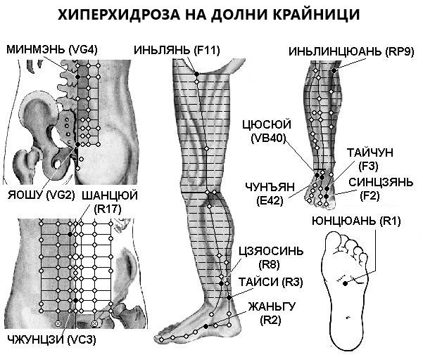 ПОТЛИВОСТ - ХИПЕРХИДРОЗА | ЕЛЕКТРОПУНКТУРА