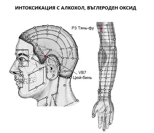 ИНТОСИКАЦИЯ