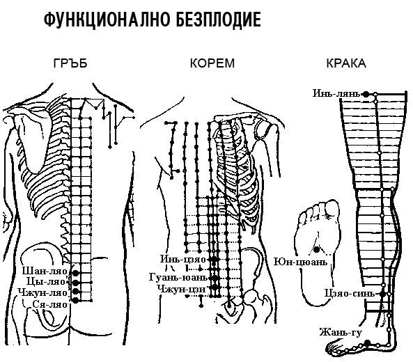 ФУНКЦИОНАЛНО БЕЗПЛОДИЕ | ЕЛЕКТРОПУНКТУРА