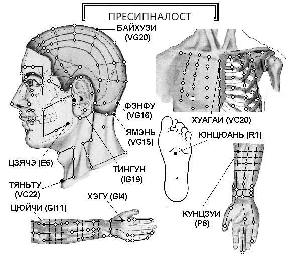 ПРЕСИПНАЛОСТ | ЕЛЕКТРОПУНКТУРА