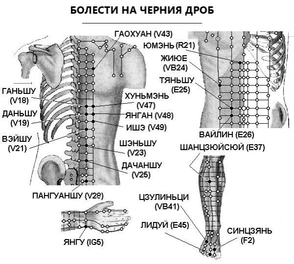 БОЛЕСТИ НА ЧЕРНИЯ ДРОБ