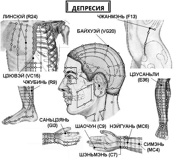 ДЕПРЕСИЯ | ЕЛЕКТРОПУНКТУРА