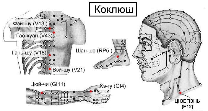 КОКЛЮШ | ЕЛЕКТРОПУНКТУРА